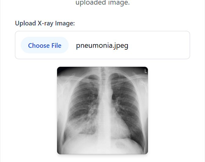 Screenshot of Pneumonia Prediction App
